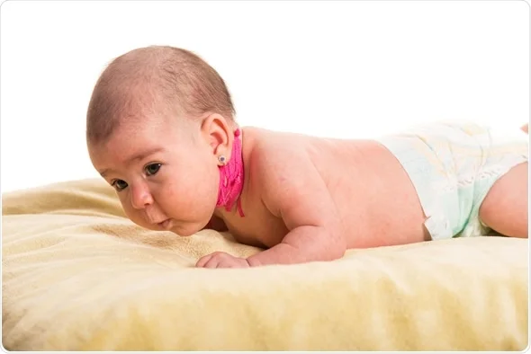 Torticollis Treatment In Pune