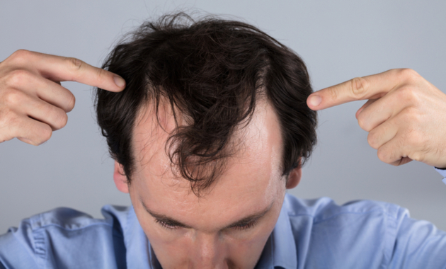 Hair Loss Treatment In Pune