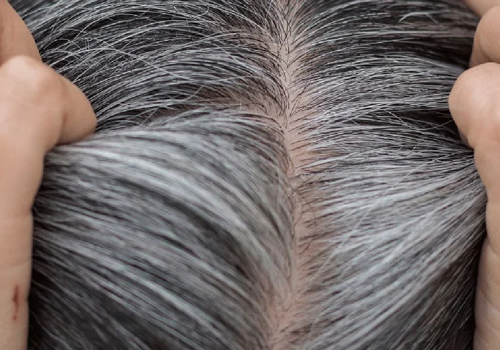 Premature Greying of Hair Treatment in Pune