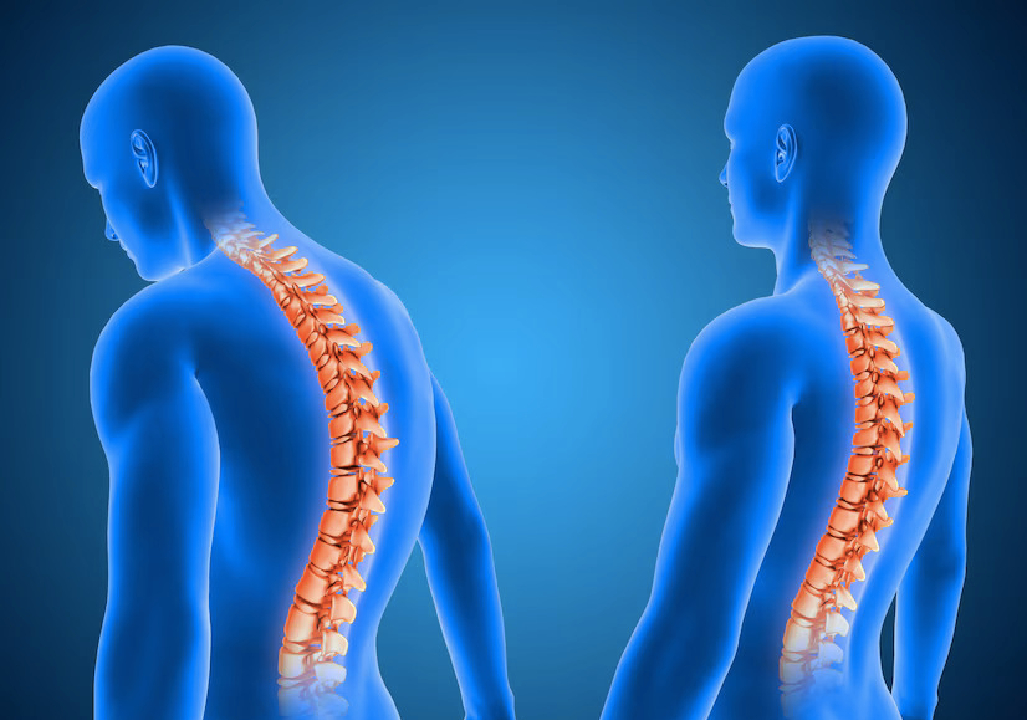 Spine Surgery In Pune